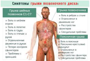 Ортопедический корректор позвоночника